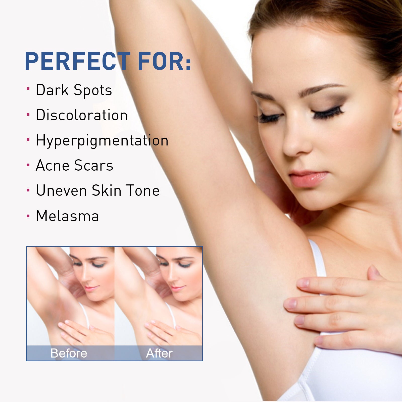Body Whitening Cream Fade - Skin Beauty Cream